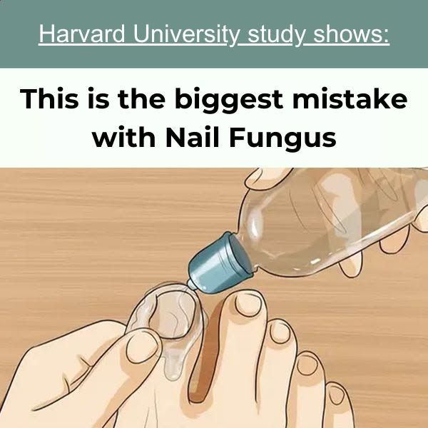 Classic darn