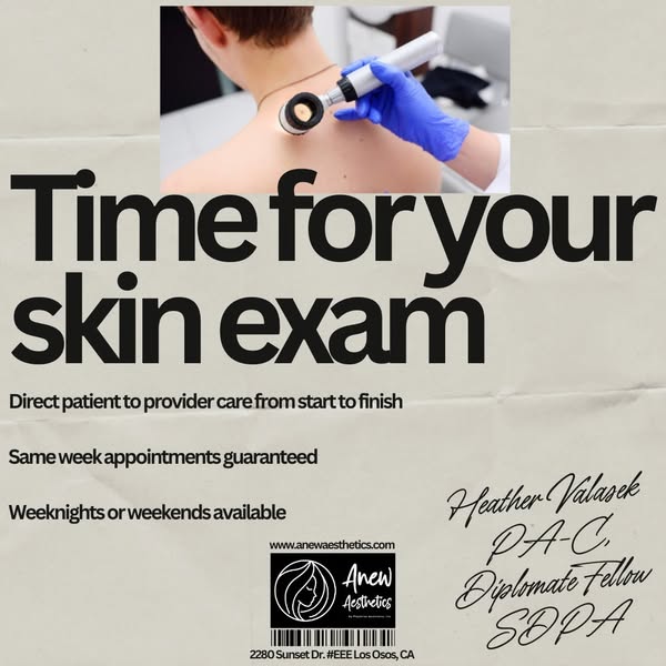 melanoma