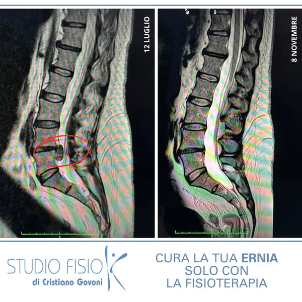 info