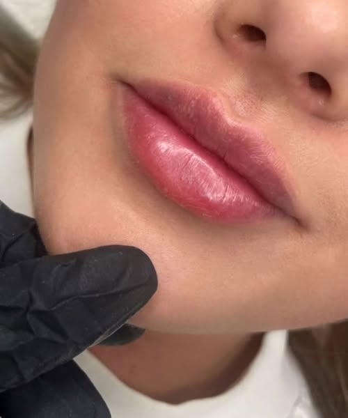 Stunning client