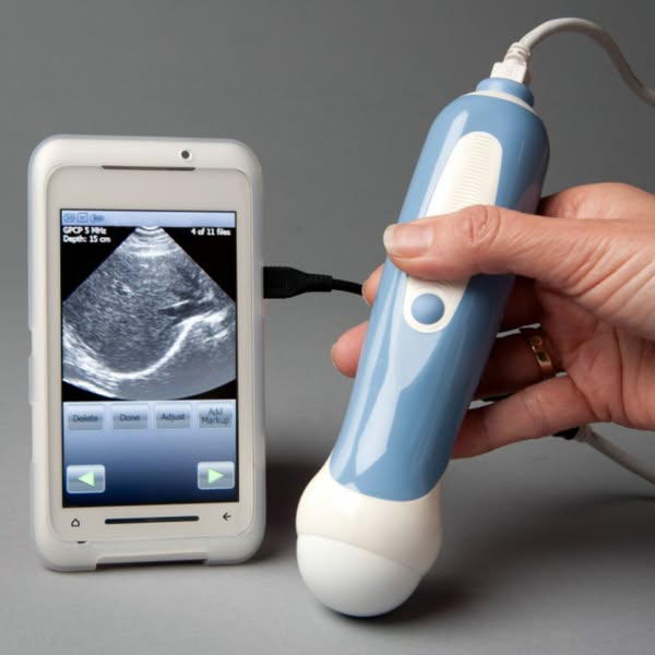 Portable Ultrasound Device