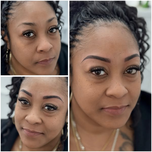 Flawless procedure