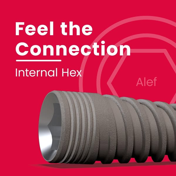 Versatile connection