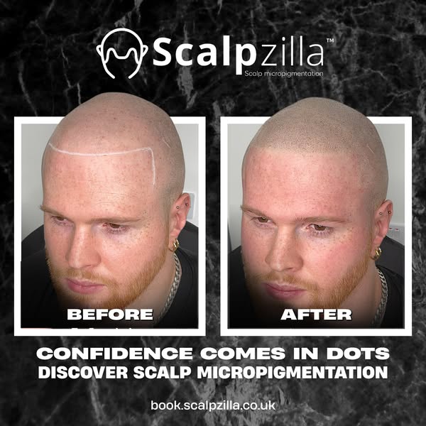 Affordable bald