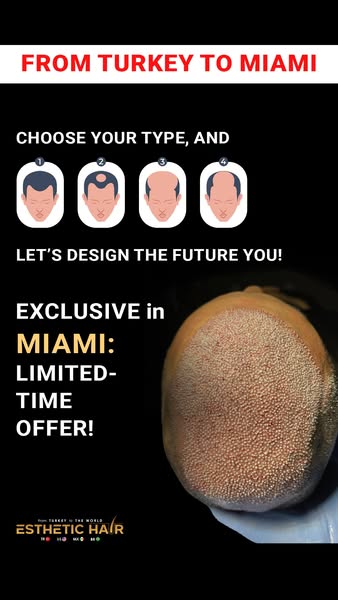 Exclusive Offer
