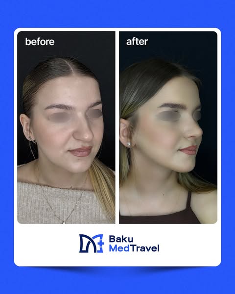 Renewed self-confidence