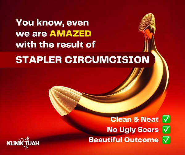 Modern circumcision