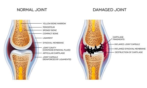 Compact cartilage