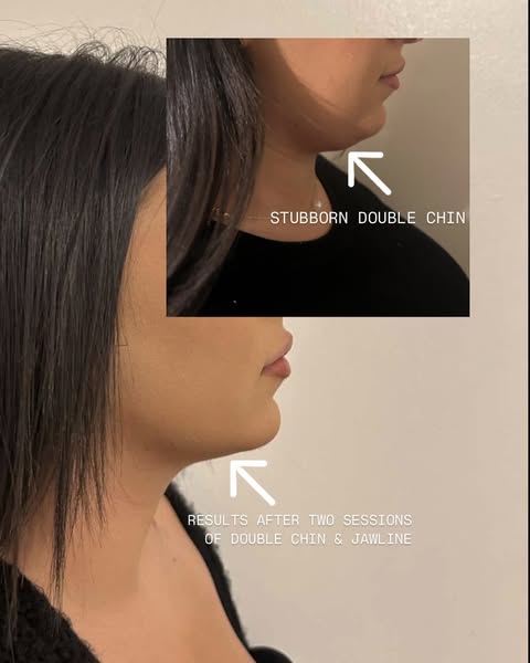Natural sculpted