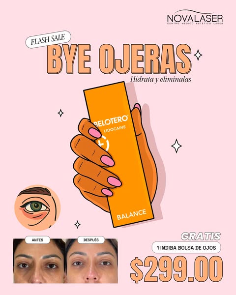 Flash Sale