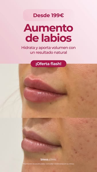 Natural prom