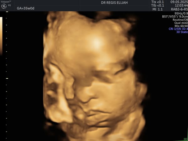 Advanced scan