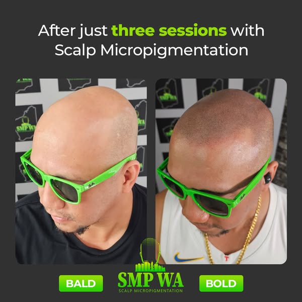 Affordable bald