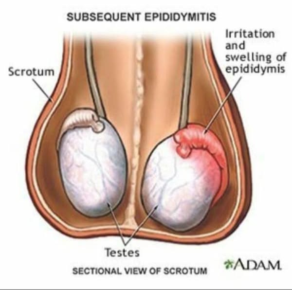 Quality gland