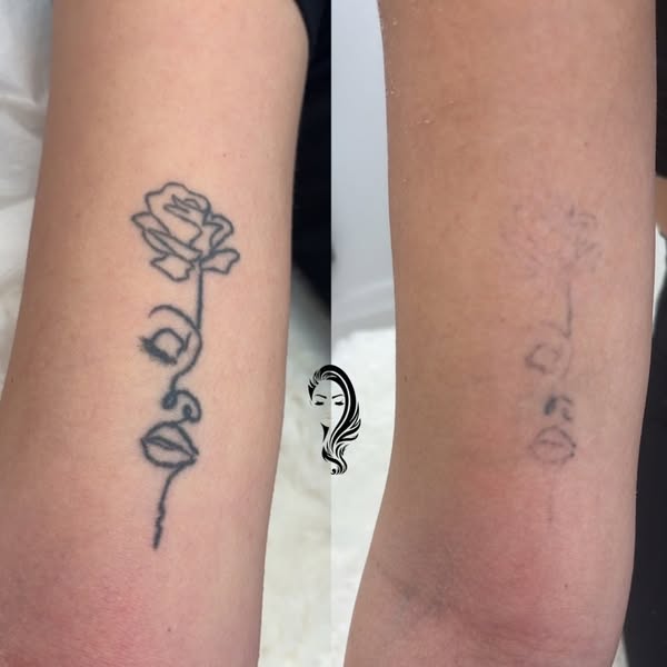 Advanced tattoo
