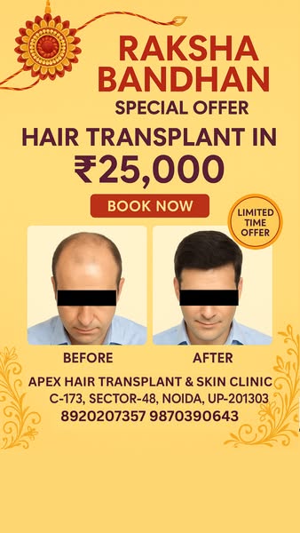 Limited Time Offer