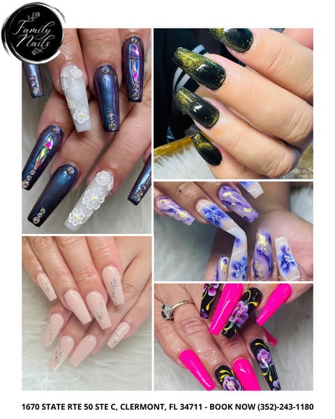 Exquisite array