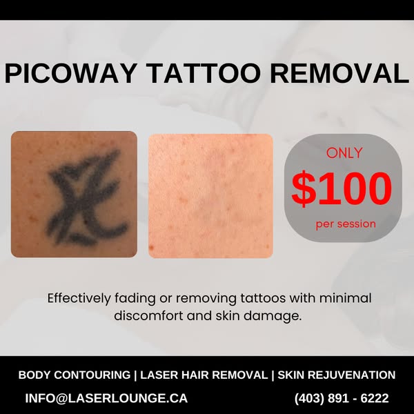 Advanced tattoo