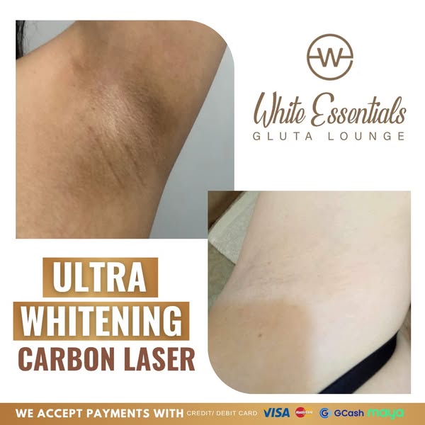 Unlimited white