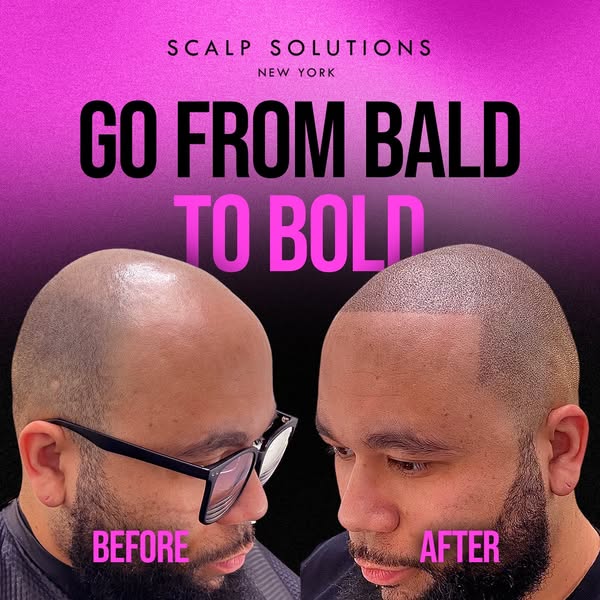 Affordable bald