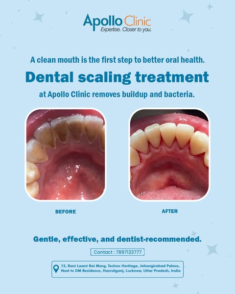 Oral Care