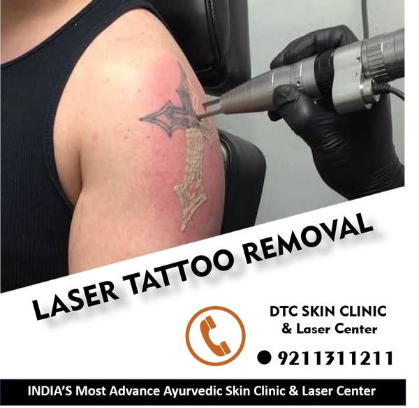 Safe tattoo