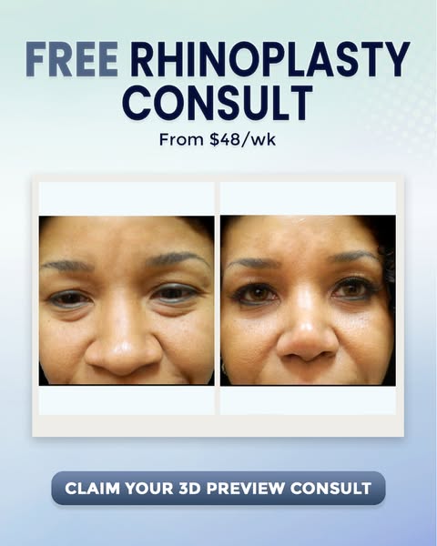 Personalized consult