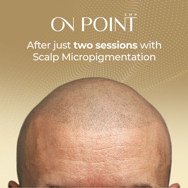 Cost-effective scalp