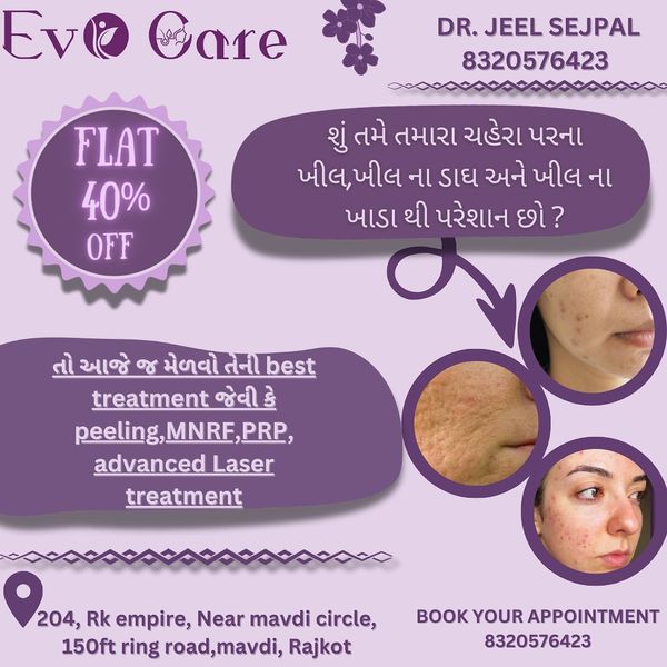 Acne Treatment