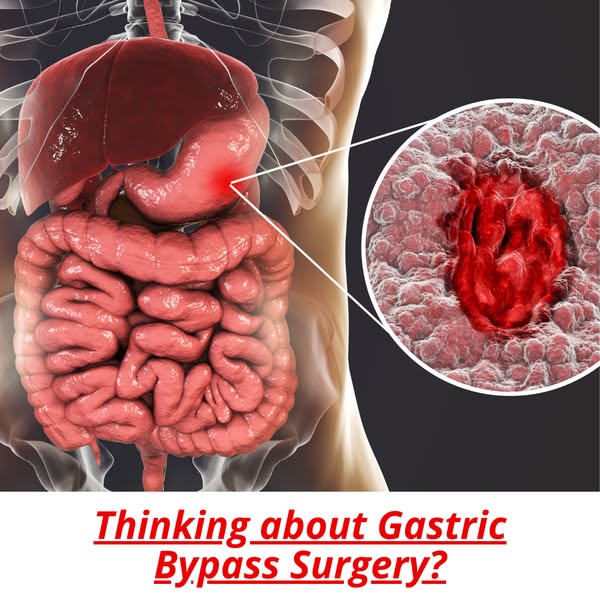 gastric