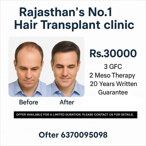 Affordable bald