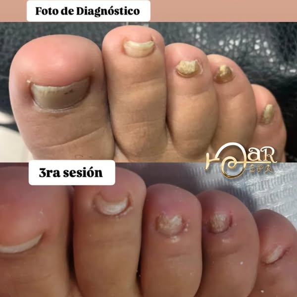 mar