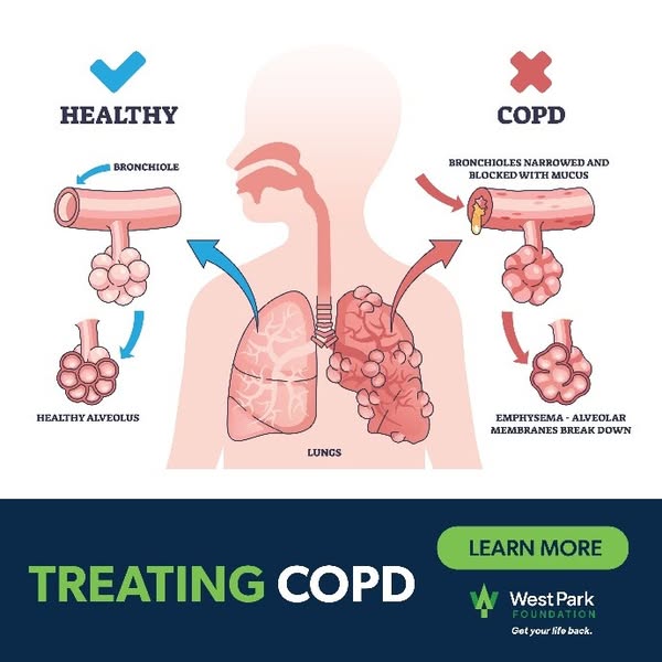 Healthy emphysema