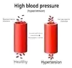 Healthy measured