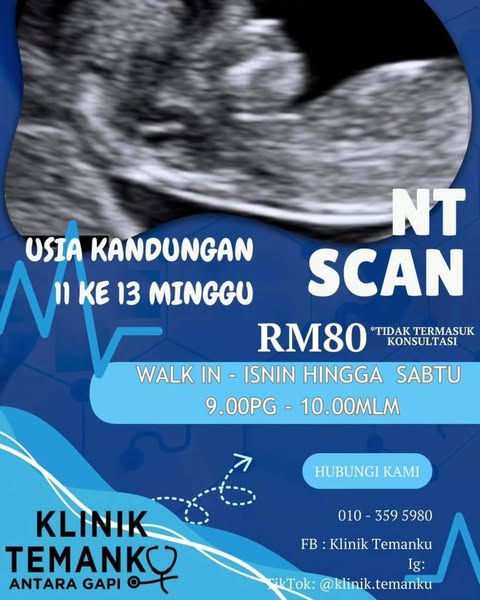 Affordable slot