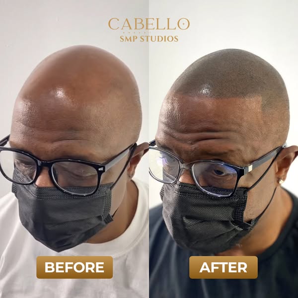 Affordable appearance