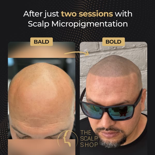 Affordable bald