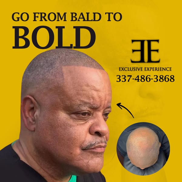 Affordable bald