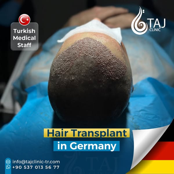 Ideal transplant