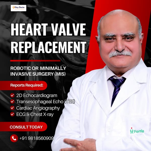 Modern valve