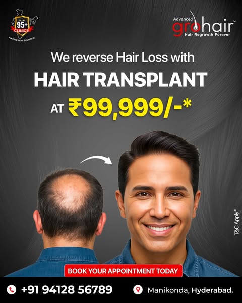 Affordable bald