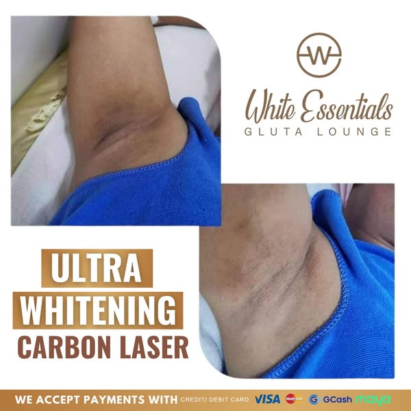 Unlimited white