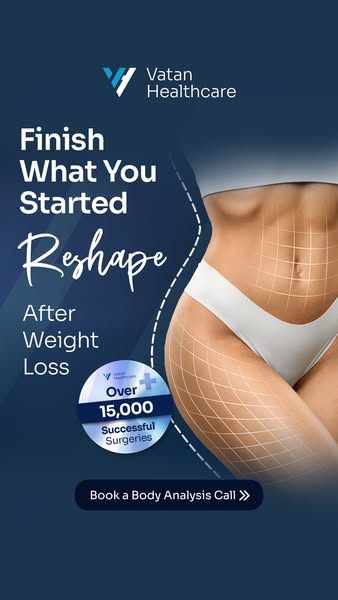reshape