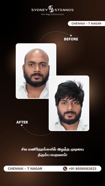Unmatched voluminous