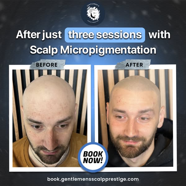 Affordable appearance