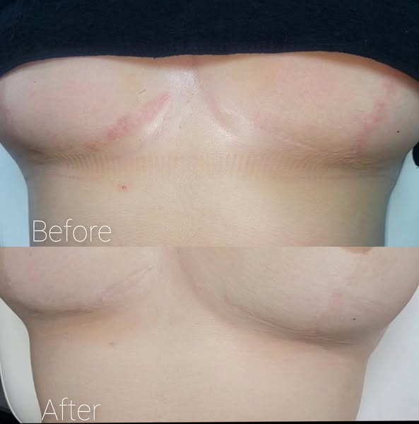 Prominent restoring