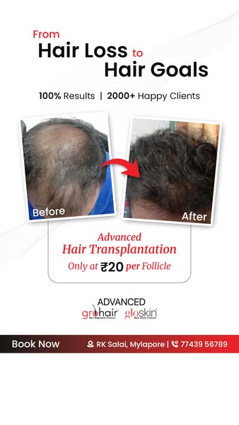 Advanced transplantation