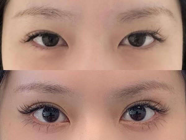 Seamless eyelid