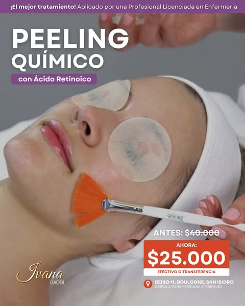 Ideal acne