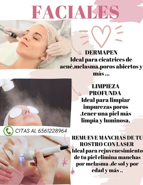 Ideal acne